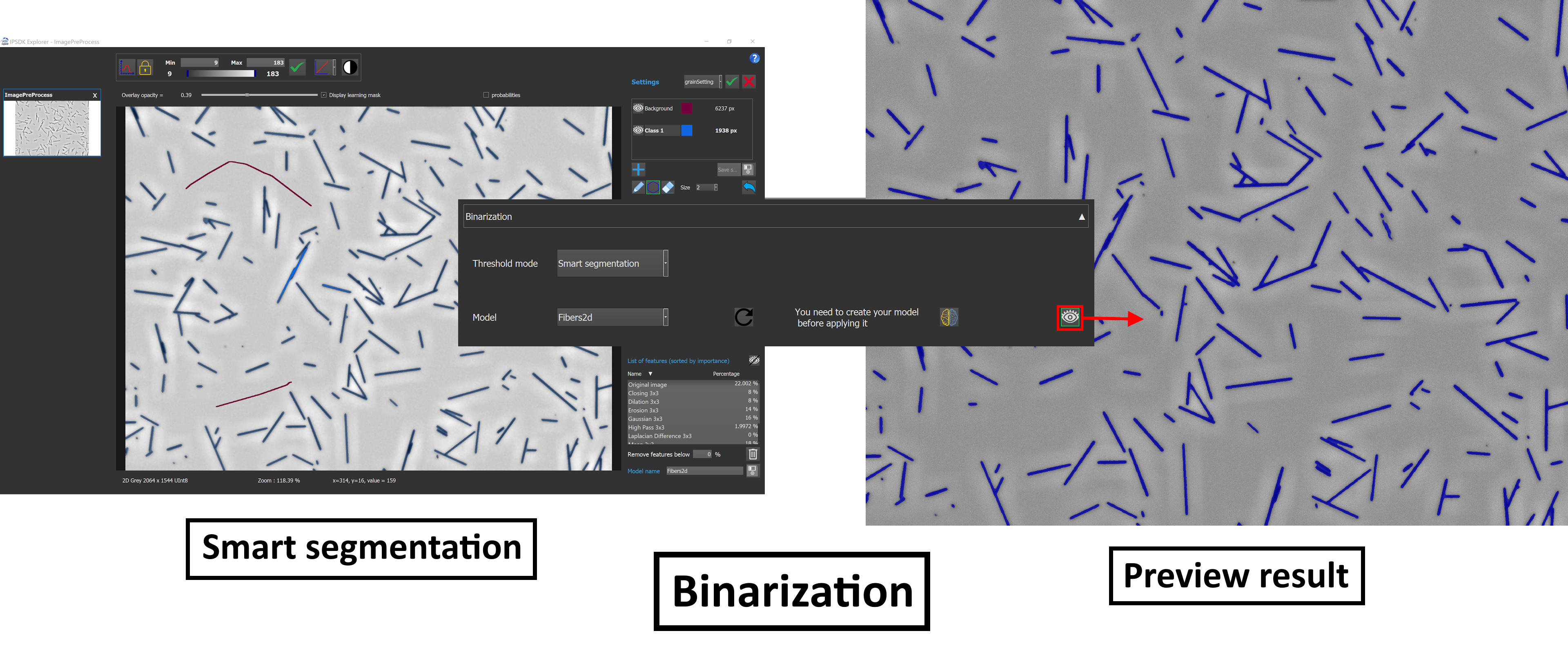 fibersPlugin_binarization_smartSegmentation.png