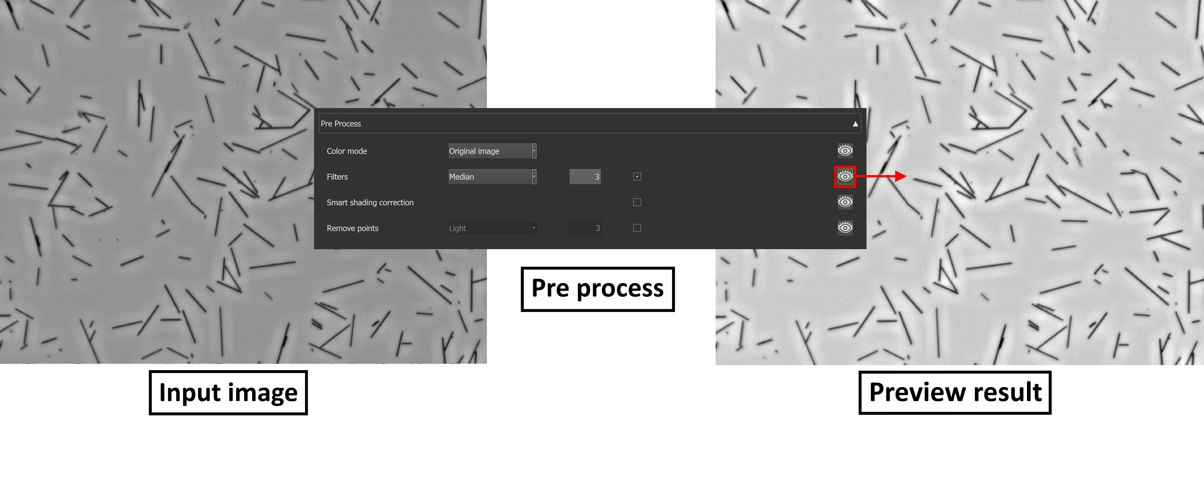 fibersPlugin_preprocess.png