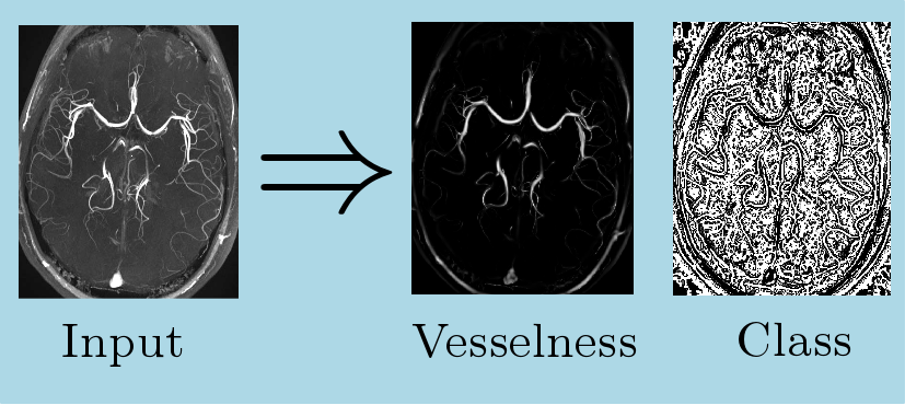 MultiscaleVesselEnhancement2dImg.png