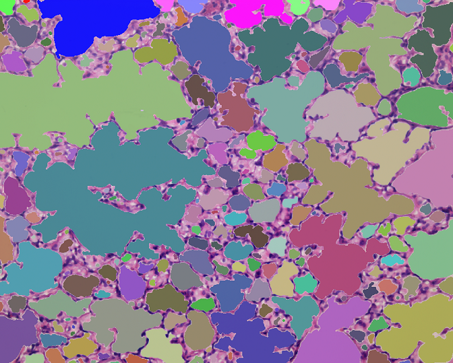 AlveoliDetection