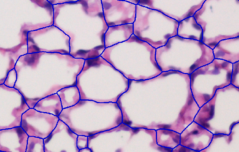 AlveoliLines Alveoli line separator