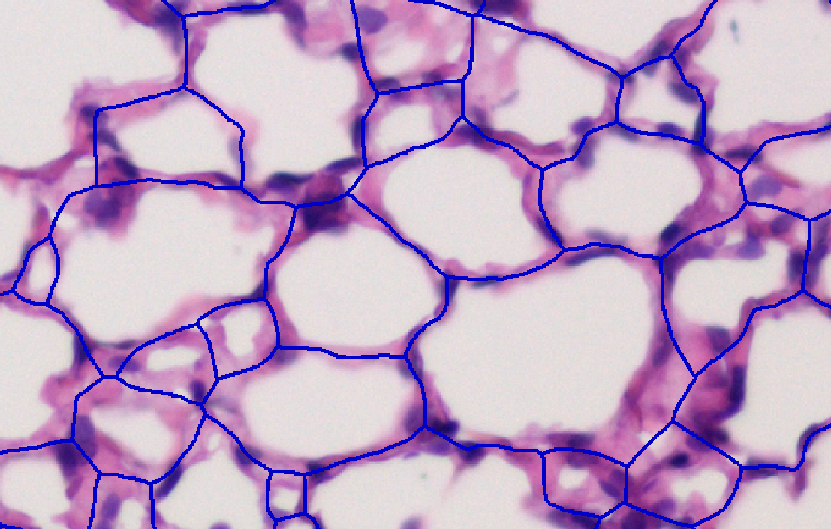 Alveoli line separator