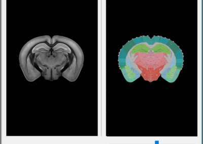 Autoradiography Processing with Atlas