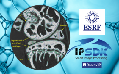IPSDK SMART Segmentation : ESRF use case