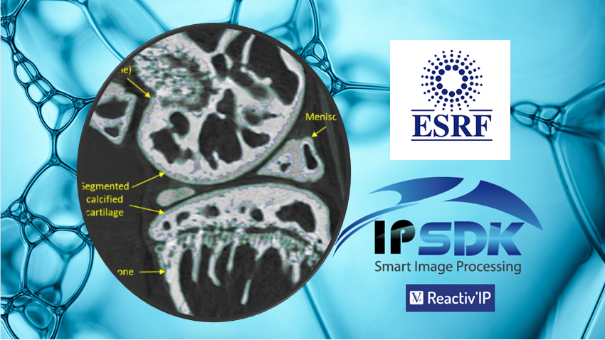 Machine Learning Smart segmentation ESRF