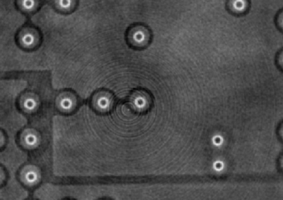 Suppression des ring artefacts