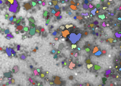 TEM image of sub-micron lithium metal particle analyze