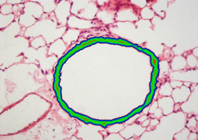 Paroi bronchiole