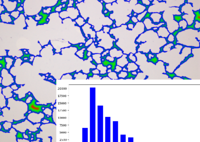 Inter-alveolar wall thickness