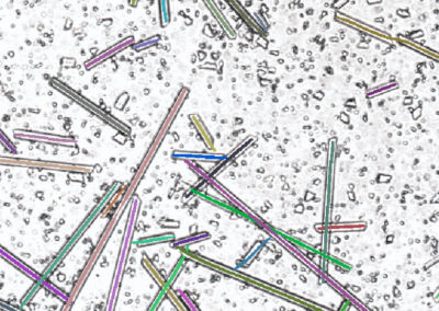 Segmentation de fibres